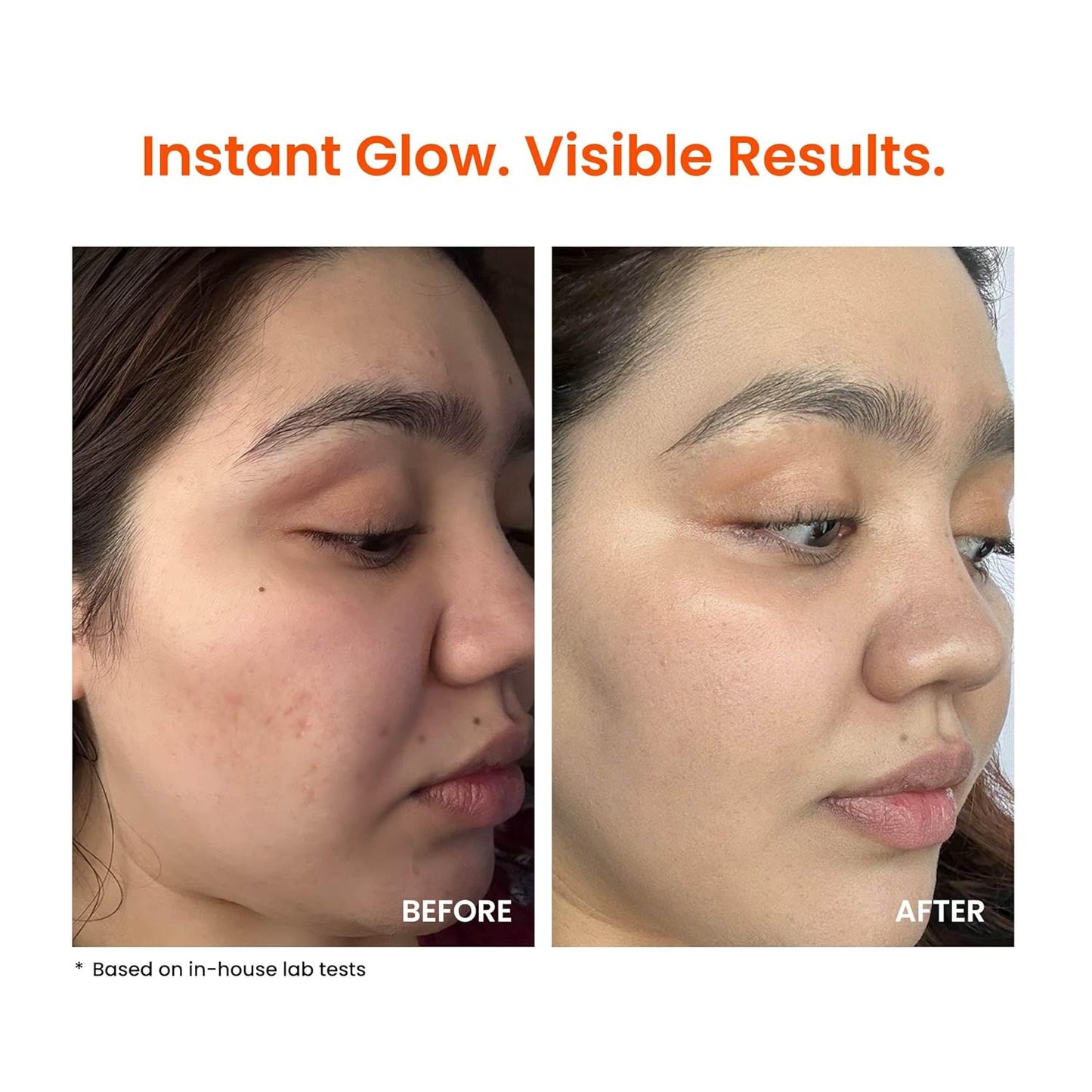 Foxtale Vitamin C Super Glow Moisturizer with Niacinamide & Peptides, Visibly Reduces Pigmentation, Enhances Skins Brightness Instantly, For All Skin Types, Women & Men - 50ml, Cream