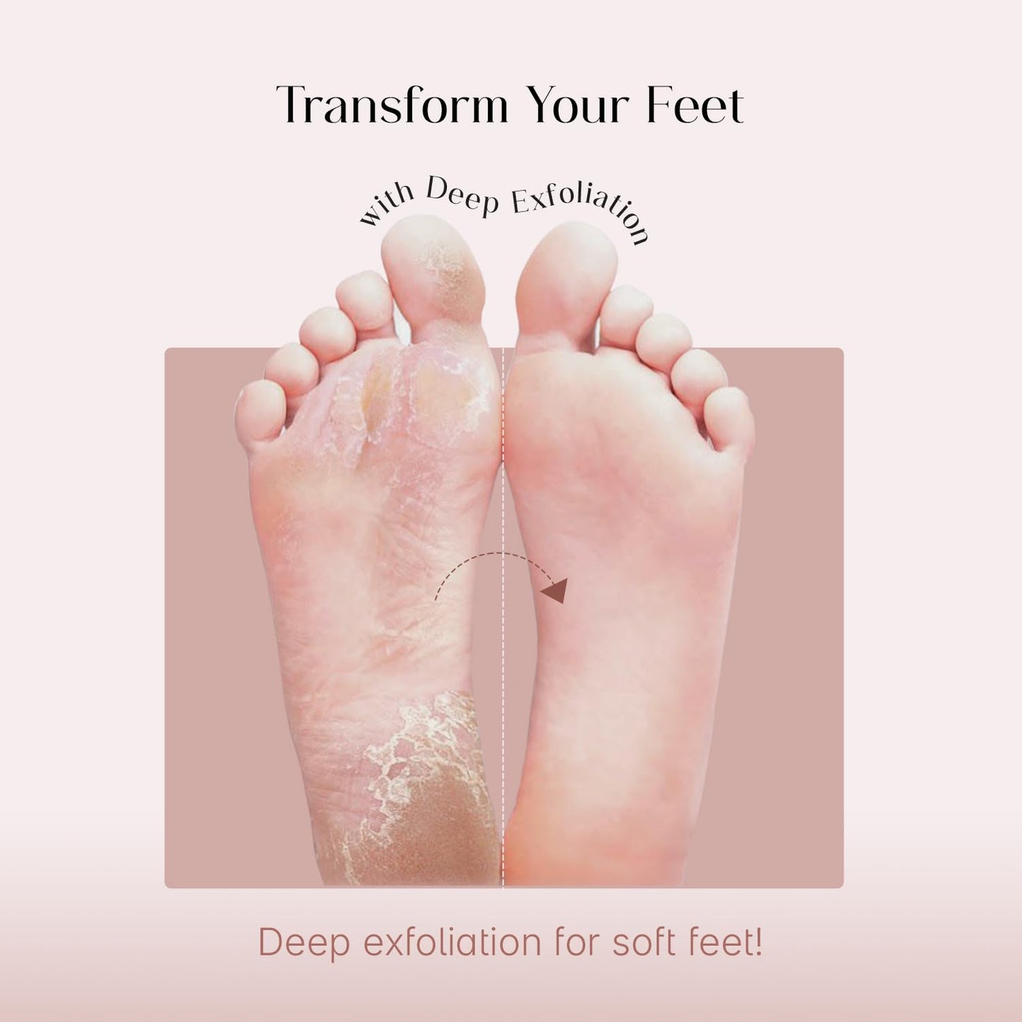 SeoulSkin Glycolic Acid Foot Peeling Mask (1 Pair), Korean Peeling & Exfoliating | Deep Exfoliation with Glycolic Acid, Removes Dead Skin, Cruelty-Free, Foot Peel Off Mask