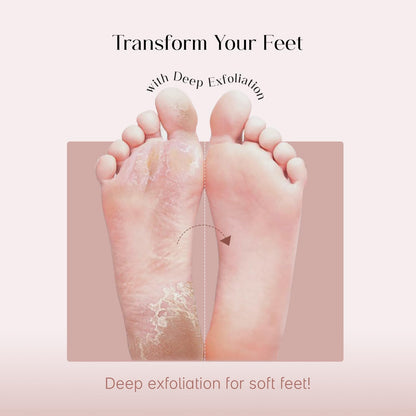 SeoulSkin Glycolic Acid Foot Peeling Mask (1 Pair), Korean Peeling & Exfoliating | Deep Exfoliation with Glycolic Acid, Removes Dead Skin, Cruelty-Free, Foot Peel Off Mask