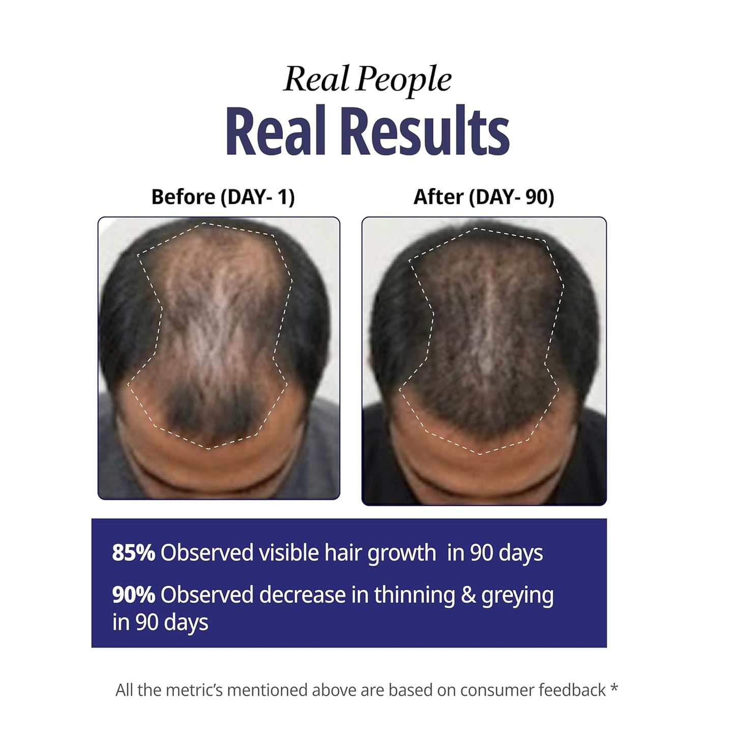 Reginald Men Athena- All in one Hair Serum | Hair Fall Control & Follicle Boost with 12 Actives | Advanced Hair Growth Serum For Scalp | Controls HairFall & Boosts New Hair Growth | For Men | 60ml