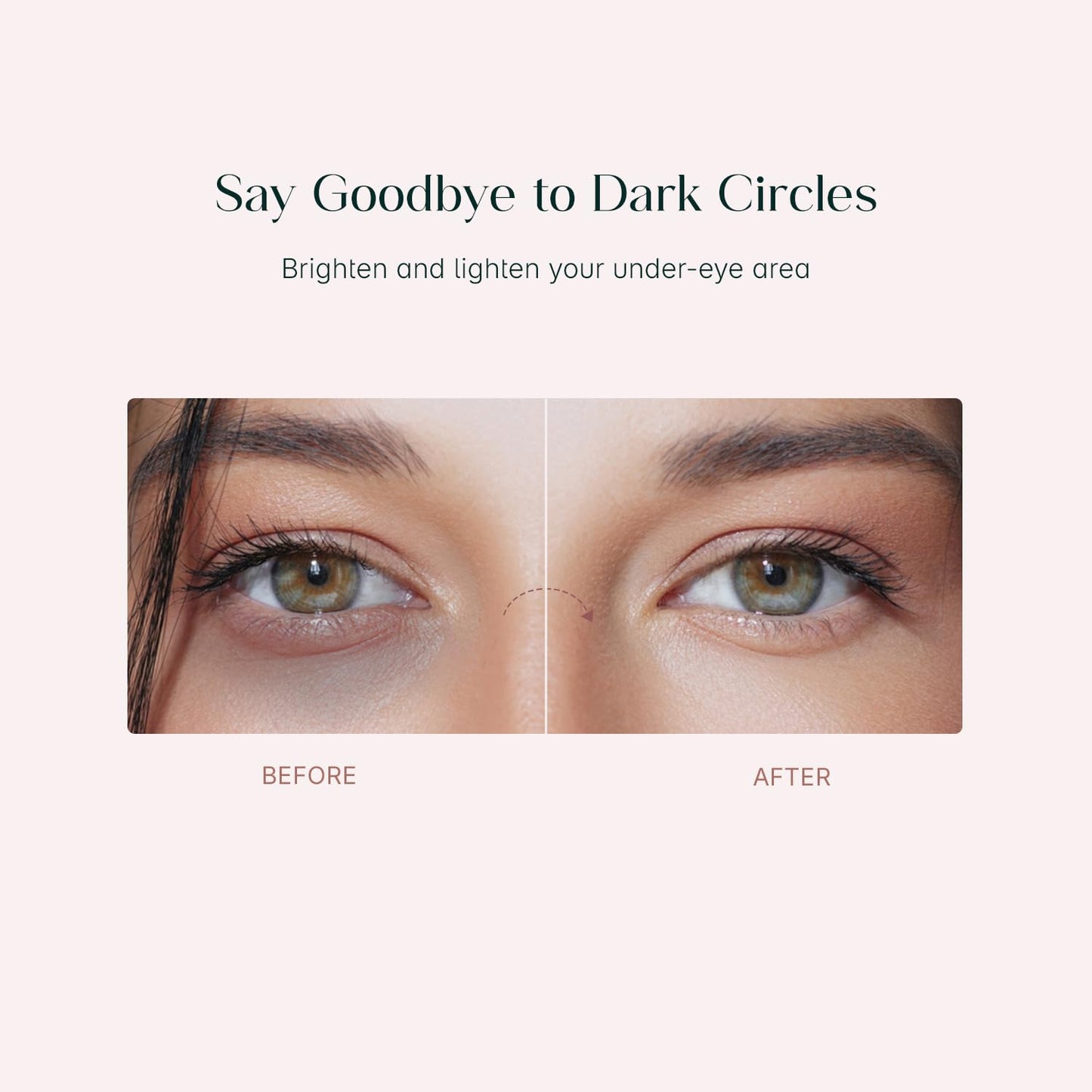 SeoulSkin Snail Mucin Under Eye Serum Patches (32 Pcs) – Korean Eye Patches for Dark Circles, Puffy Eyes, Hydrates & Repairs with Niacinamide & Hyaluronic Acid – Paraben-Free, Sulphate-Free, Cruelty-Free