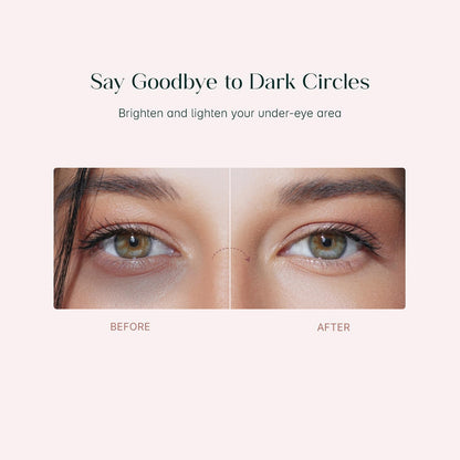 SeoulSkin Snail Mucin Under Eye Serum Patches (32 Pcs) – Korean Eye Patches for Dark Circles, Puffy Eyes, Hydrates & Repairs with Niacinamide & Hyaluronic Acid – Paraben-Free, Sulphate-Free, Cruelty-Free