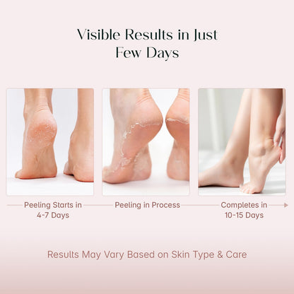 SeoulSkin Glycolic Acid Foot Peeling Mask (1 Pair), Korean Peeling & Exfoliating | Deep Exfoliation with Glycolic Acid, Removes Dead Skin, Cruelty-Free, Foot Peel Off Mask