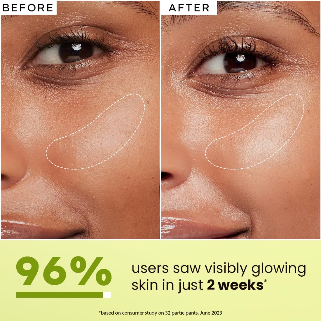 Hyphen 5% Niacinamide, 1% Alpha Arbutin & 25% Kakadu Plum Brightening Face Serum | 20X Vitamin C for Glowing Winter Skin | All Skin Types – 15ml