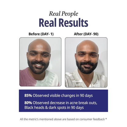 Reginald Men Apollo - Hydrating Face & Beard Wash | Deep Clean, Acne & Tan Control with 8 Actives Face Wash (300G)