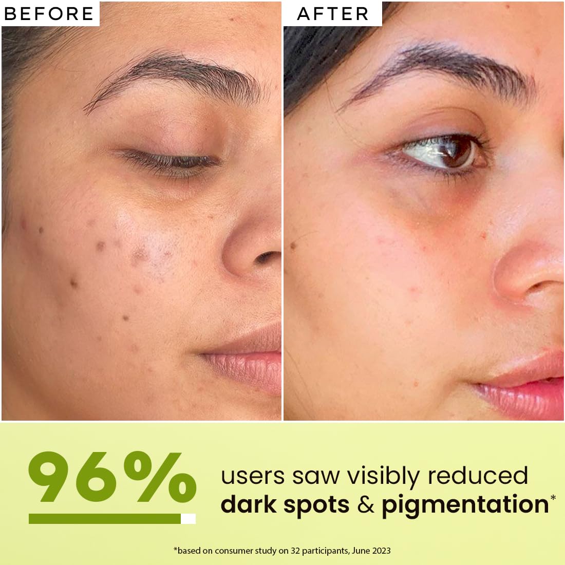 Hyphen Brightening Face Serum with 5% Niacinamide, 1% Alpha Arbutin & 25% Kakadu Plum | 20X Vitamin C for Glowing Winter Skin | All Skin Types – 30ml
