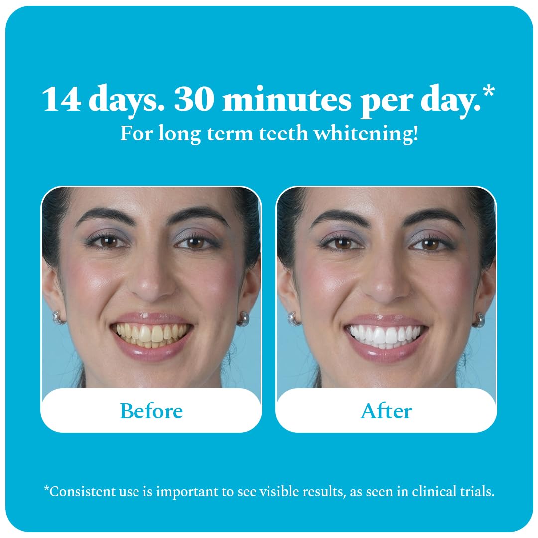 Perfora Teeth Whitening Strips - Pack of 3 Treatments (6 Strips) – Whitens Teeth in 1 Use | Sensitivity-Free, Enamel-Safe Oral Care | PAP & Hydroxyapatite for Stain Removal | Fast & Effective Teeth Whitening Products