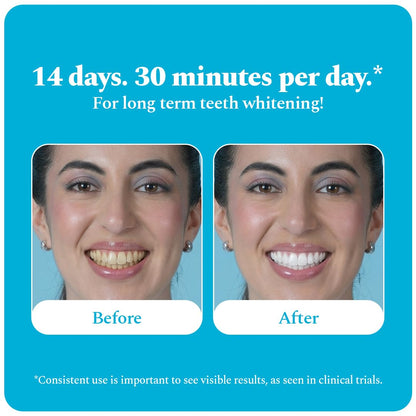 Perfora Teeth Whitening Strips - Pack of 3 Treatments (6 Strips) – Whitens Teeth in 1 Use | Sensitivity-Free, Enamel-Safe Oral Care | PAP & Hydroxyapatite for Stain Removal | Fast & Effective Teeth Whitening Products