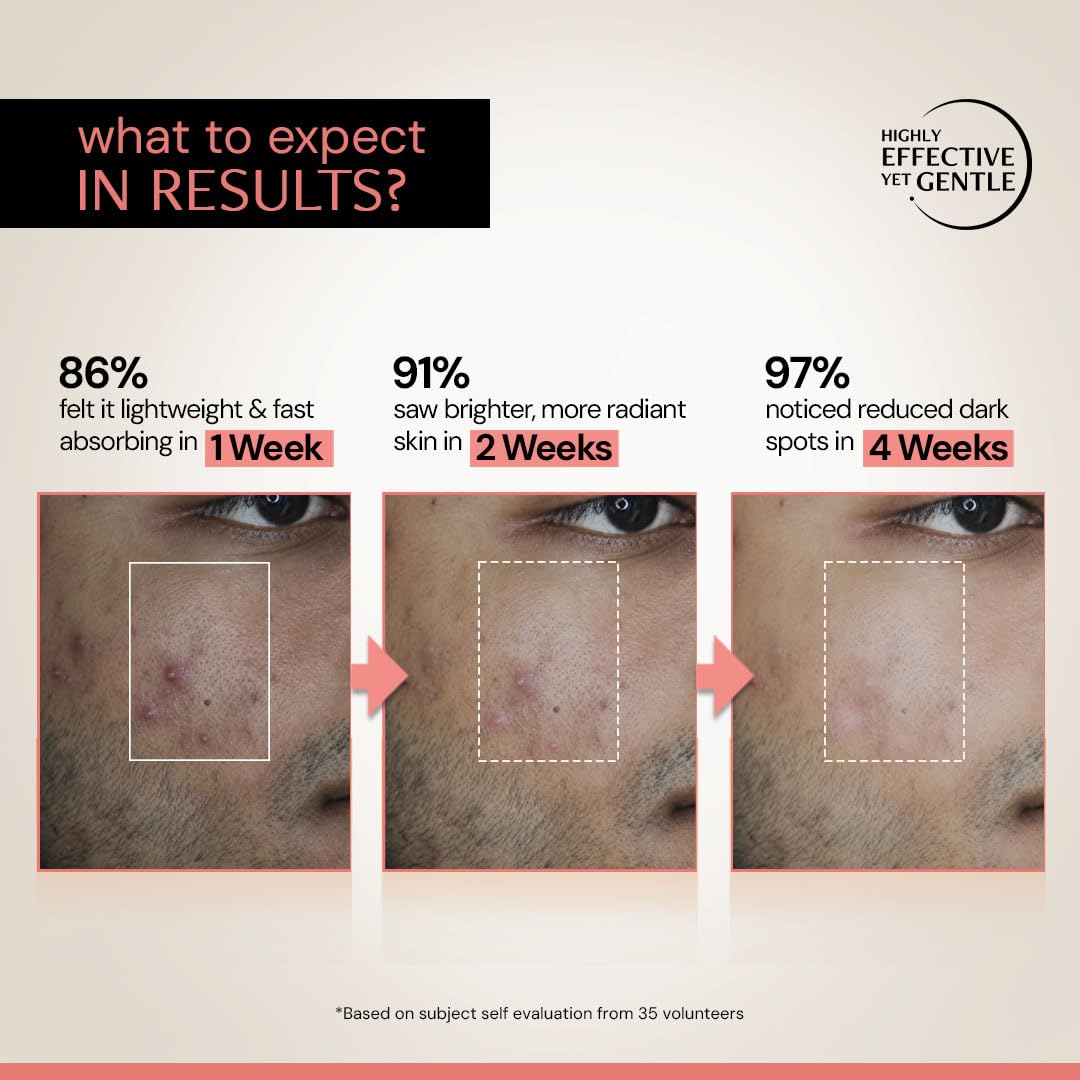 Deconstruct 5% Niacinamide Serum for Oily Skin + 2% Alpha Arbutin | Powered by Liposomal Technology | 30ml