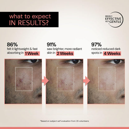 Deconstruct 5% Niacinamide Serum for Oily Skin + 2% Alpha Arbutin | Powered by Liposomal Technology | 30ml