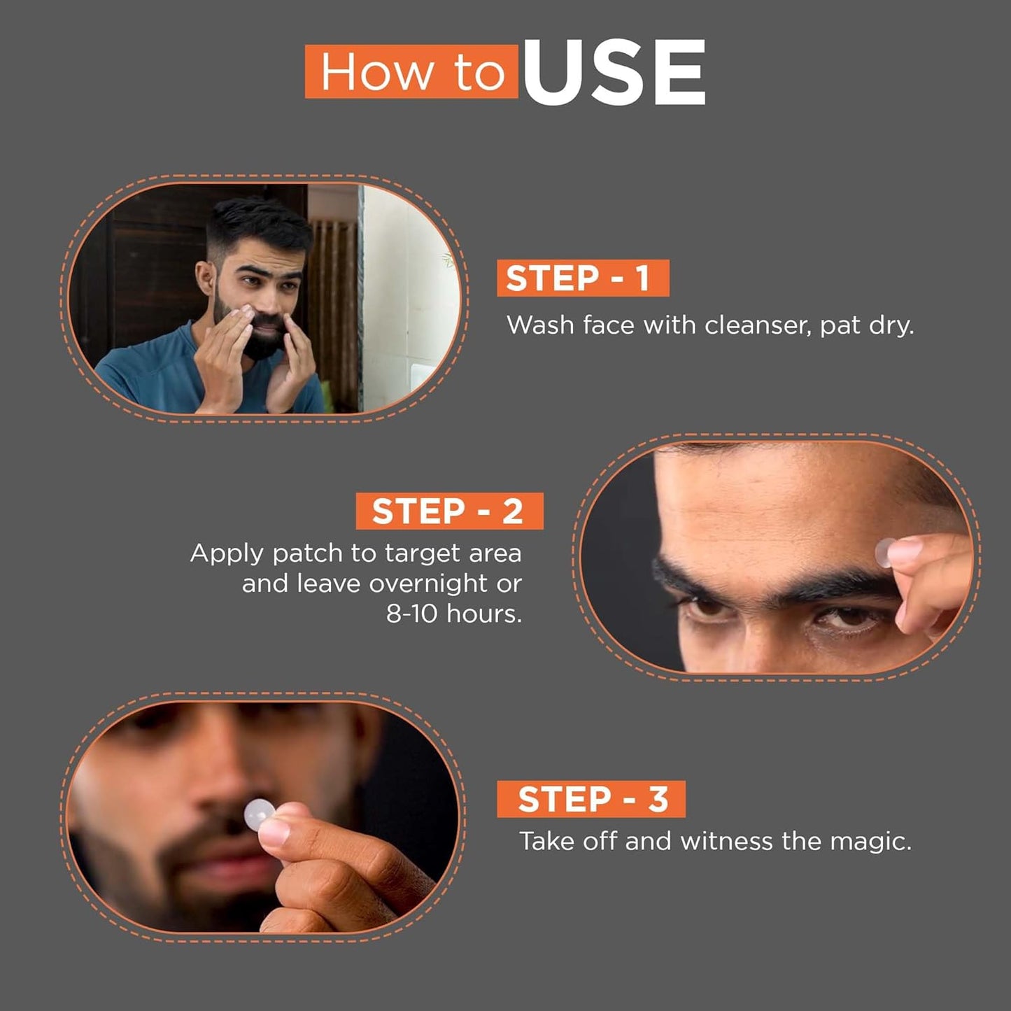 Beardhood Acne Pimple Patch | 72 Patches | Absorbs Pimple Overnight, Reduces Excess Oil, For All Skins