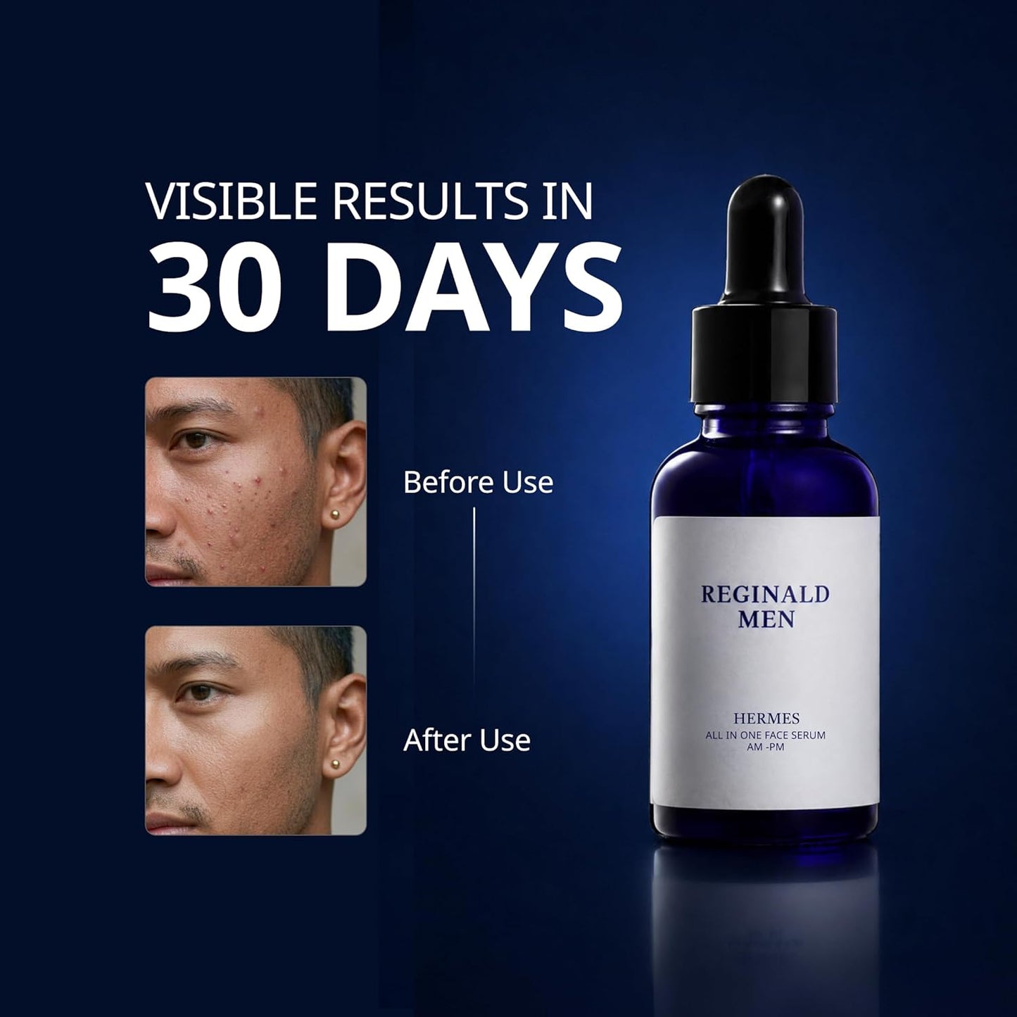 Reginald Men Hermes (30 ml) | All-in-One Face Serum for Skin & Beard Health | Multi-Functional Face & Beard Care | Hydrates, Nourishes & Strengthens | Clinically Proven Formula for Clear, Healthy Skin & Beard