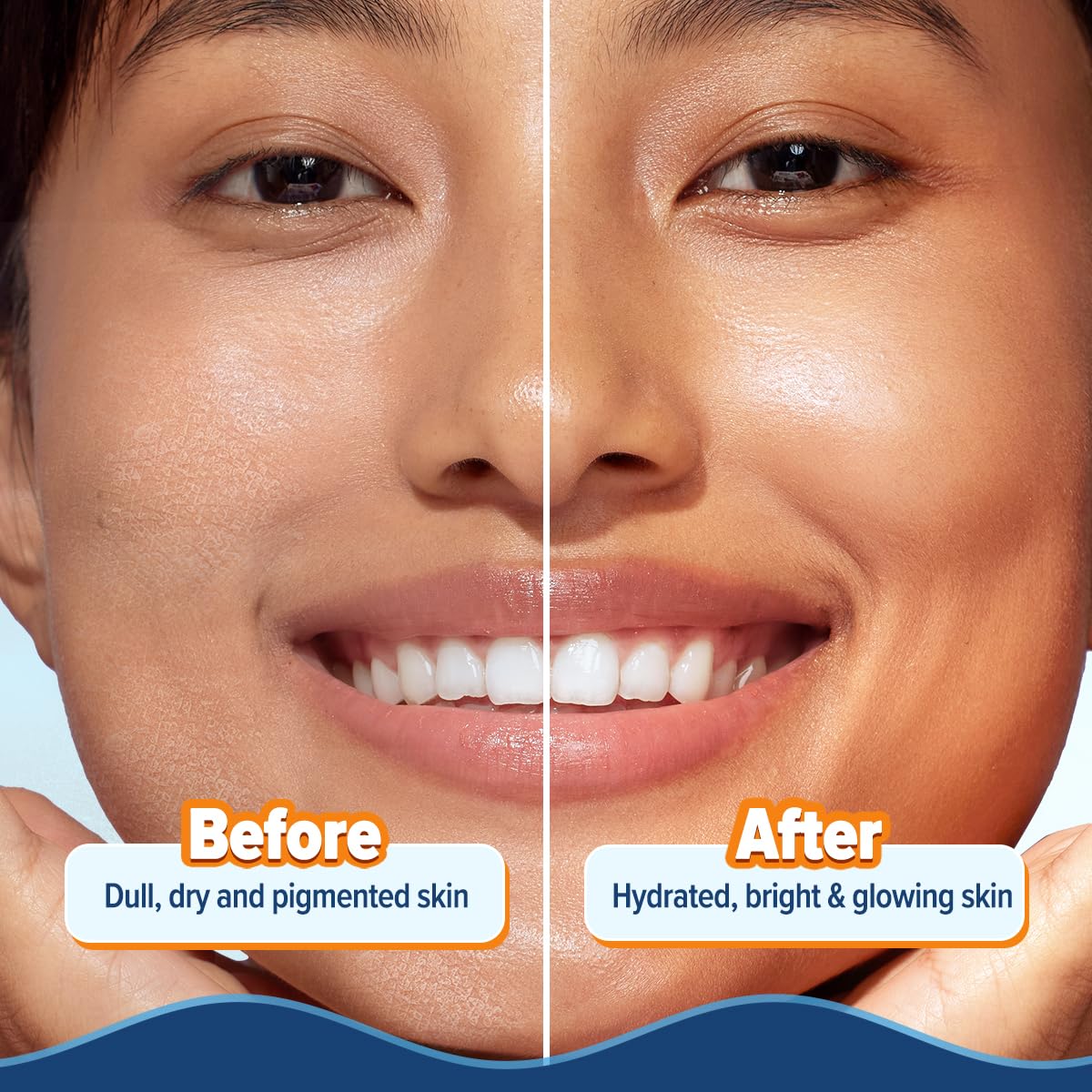 Aqualogica Glow+ Hydra Gel Moisturizer with Vitamin C & Papaya - 100 g