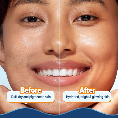 Aqualogica Glow+ Hydra Gel Moisturizer with Vitamin C & Papaya - 100 g