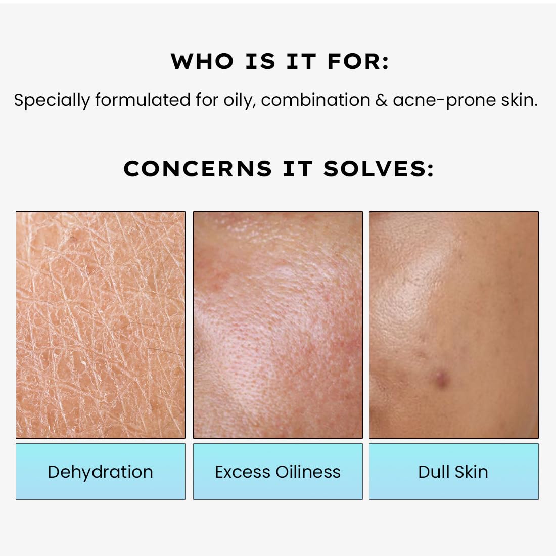 Hyphen 2% Cica Exosomes Oil-Free Moisturizer | 10X Deeper Hydration | Lightweight Water Gel with 5% Niacinamide | Controls Oil, Non-Comedogenic | Acne-Prone, Dry & Oily Skin - 50ml