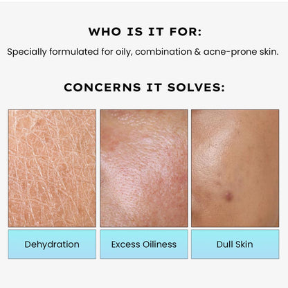 Hyphen 2% Cica Exosomes Oil-Free Moisturizer | 10X Deeper Hydration | Lightweight Water Gel with 5% Niacinamide | Controls Oil, Non-Comedogenic | Acne-Prone, Dry & Oily Skin - 50ml